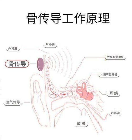 骨传导耳机是什么，骨传导耳机漏音吗